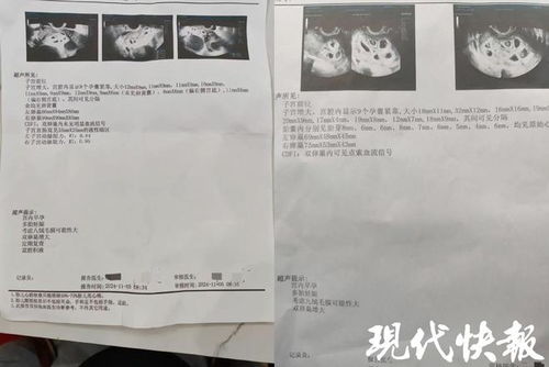 醫(yī)院回應罕見九胞胎孕婦診斷事件