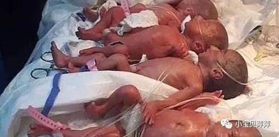 醫(yī)院回應(yīng)孕婦稱診斷出9胞胎