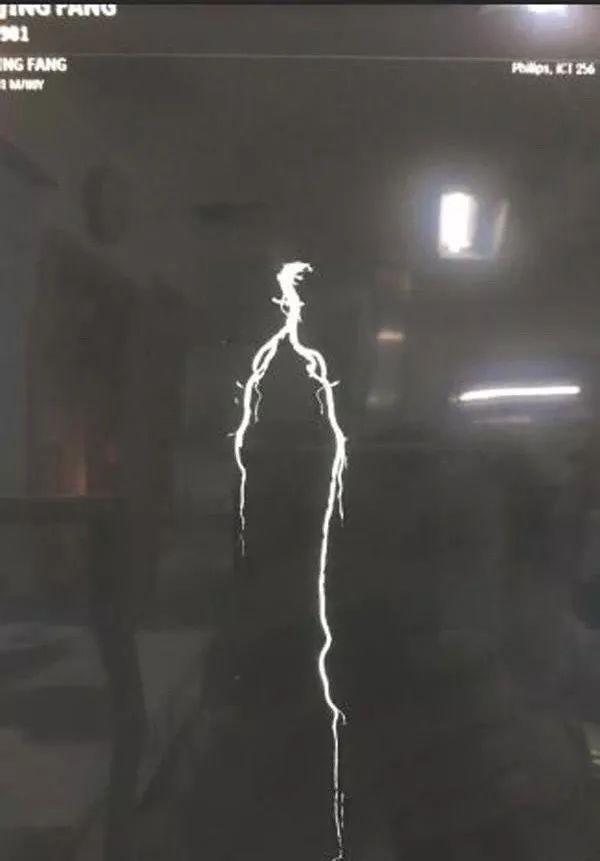 熬糖大爺與排隊中的生活無奈與堅韌