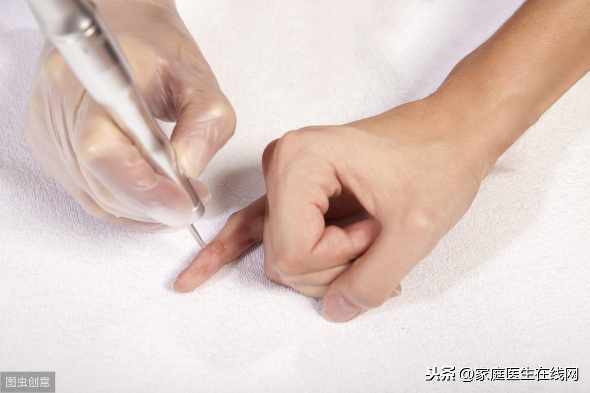 冷凍食品長(zhǎng)期儲(chǔ)存的危害與應(yīng)對(duì)策略