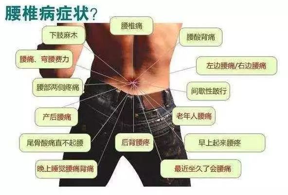 中醫(yī)改善久坐腰痛的有效方法