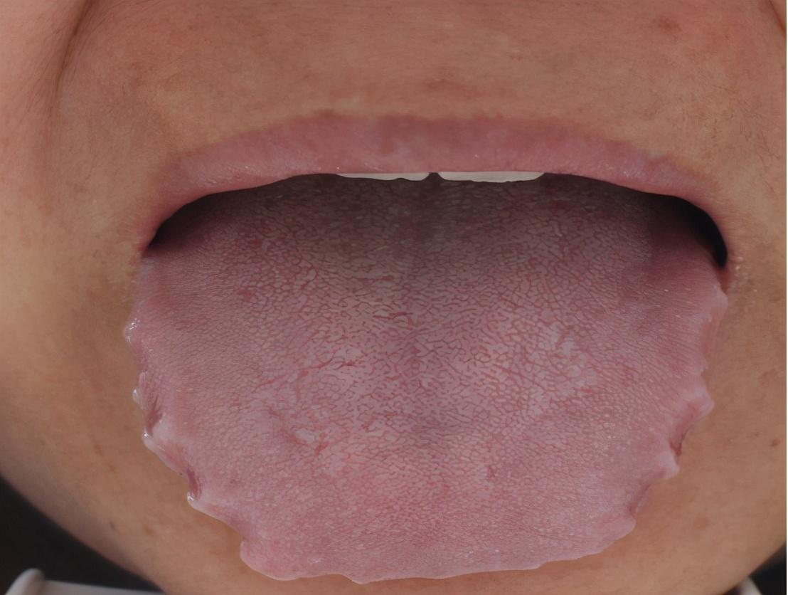 傳統(tǒng)中醫(yī)針灸，身體調(diào)節(jié)的核心奧秘