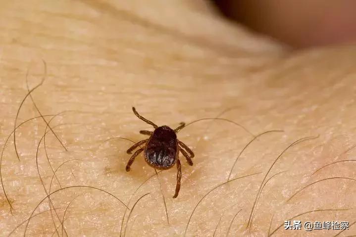 旅行中如何避免過敏反應攻略