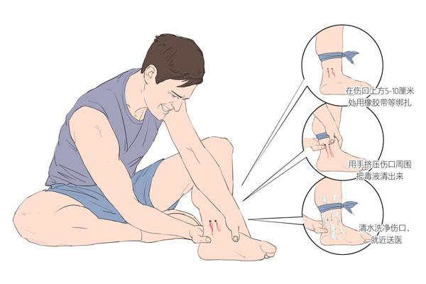 旅行必備知識(shí)，急救常識(shí)與注意事項(xiàng)全解析