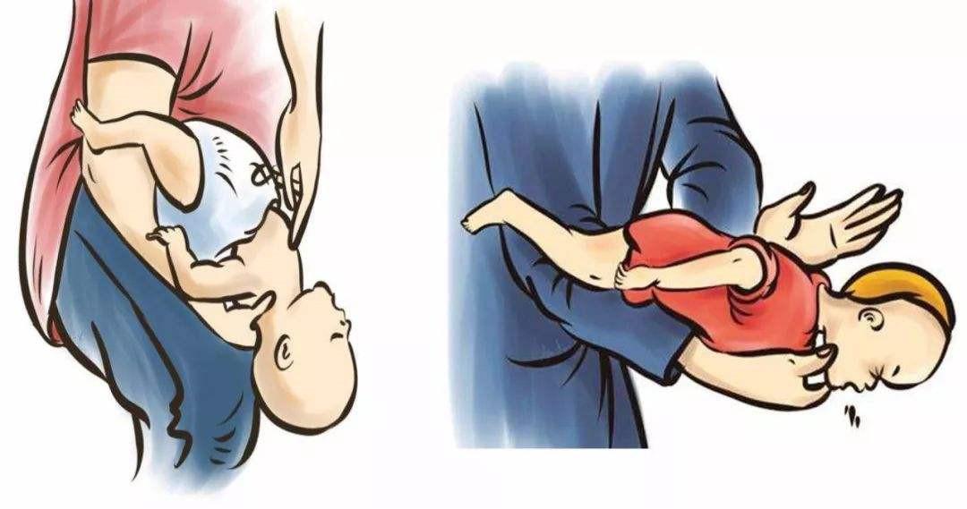 家庭急救指南，骨折傷情處理步驟