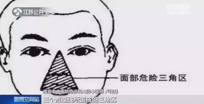 家庭常見頭痛緊急處理指南