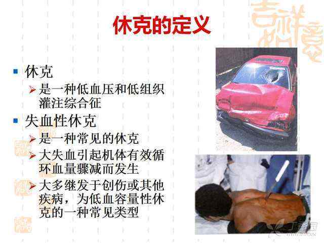 在家處理失血性休克的急救手冊