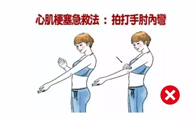 急救操作常見錯誤分析及避免策略