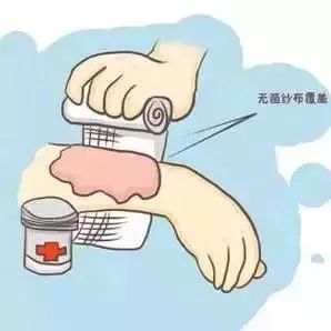 割傷傷口的正確清潔與家庭急救指南