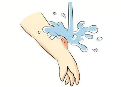 割傷傷口的正確清潔與家庭急救指南