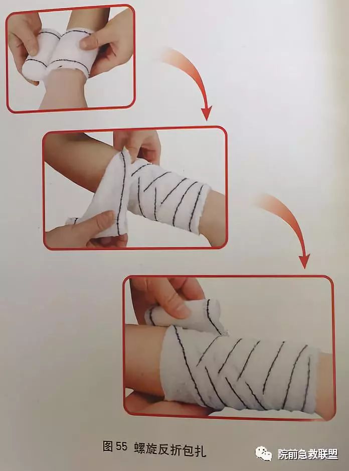 外傷創(chuàng)口的初步處理與應(yīng)急包使用指南詳解