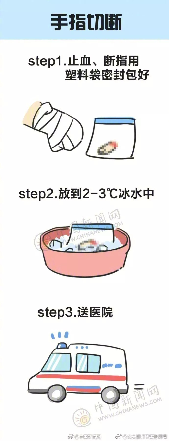 家庭急救中的常見誤區(qū)解析與避免策略