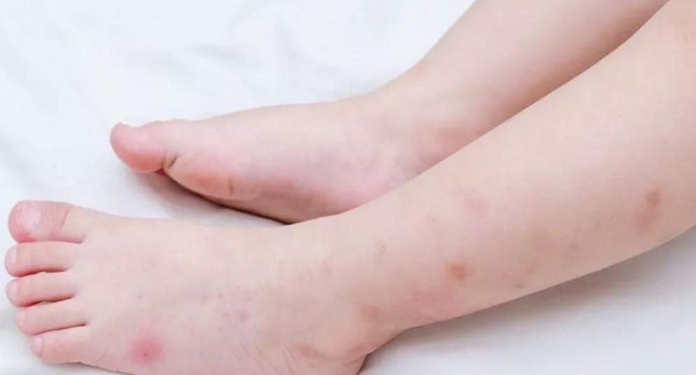 中醫(yī)在抗衰老過程中的作用與應(yīng)用探討