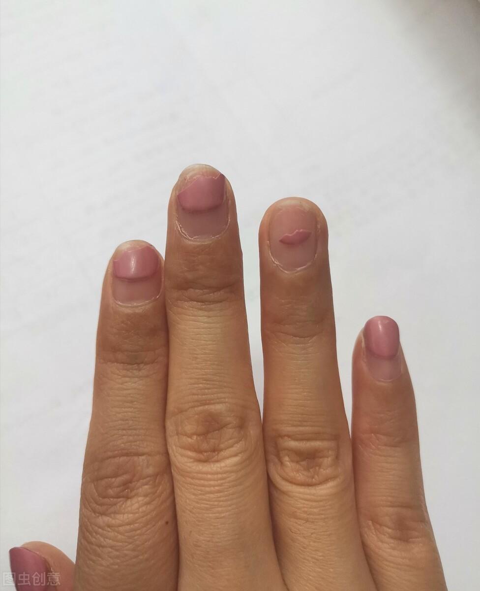 中醫(yī)肝臟調(diào)理與壓力緩解之道