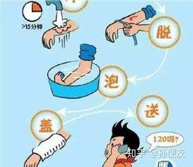 如何正確應(yīng)對(duì)家庭常見燒燙傷