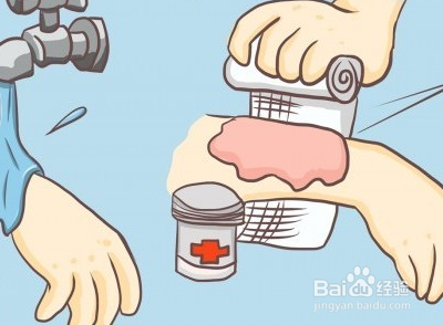 外傷感染的急救處理及預(yù)防措施