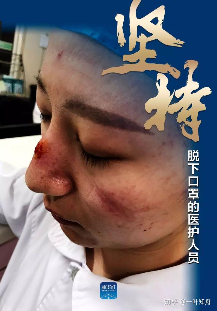 突發(fā)跌倒導(dǎo)致的頭部損傷應(yīng)對指南