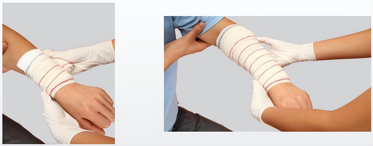 家庭成員嚴(yán)重外傷出血的應(yīng)急處理指南