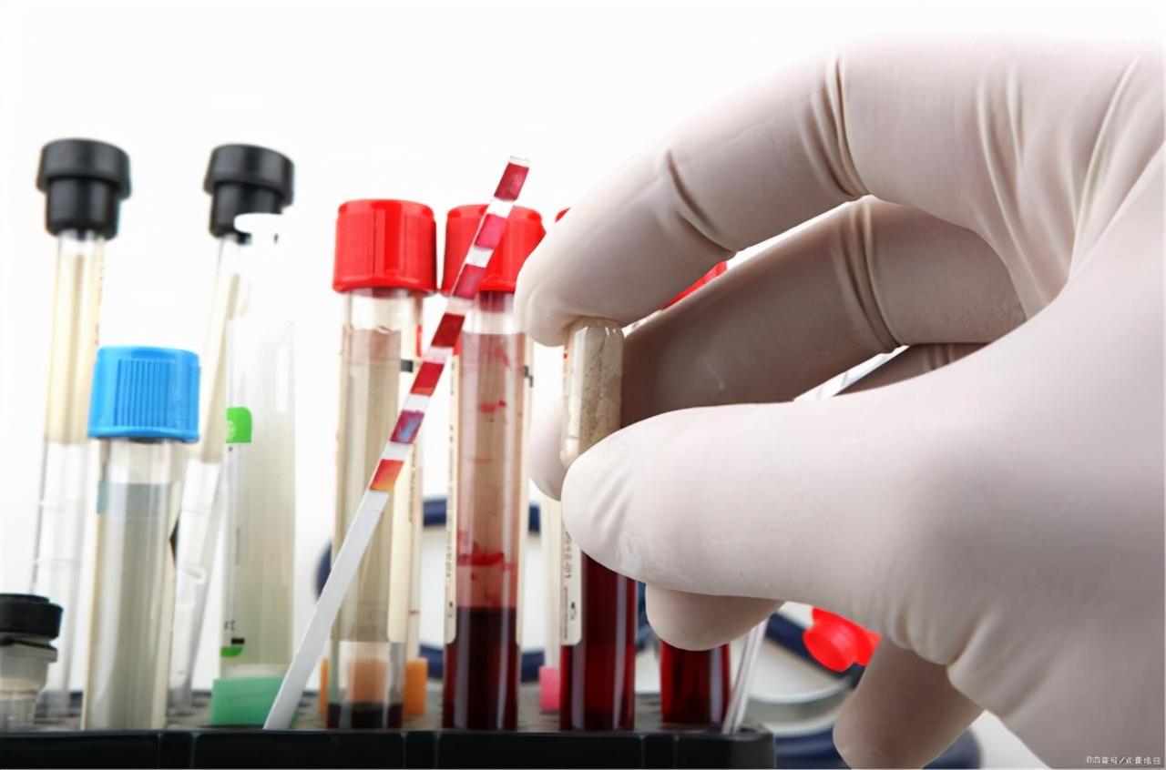 中醫(yī)調(diào)理糖尿病的有效策略