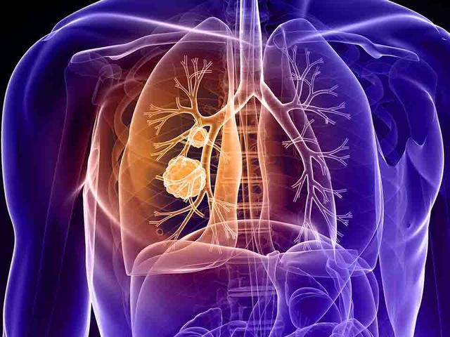 如何通過食療增強(qiáng)肺部功能,智能優(yōu)化路徑提升_璀璨版37.66.82