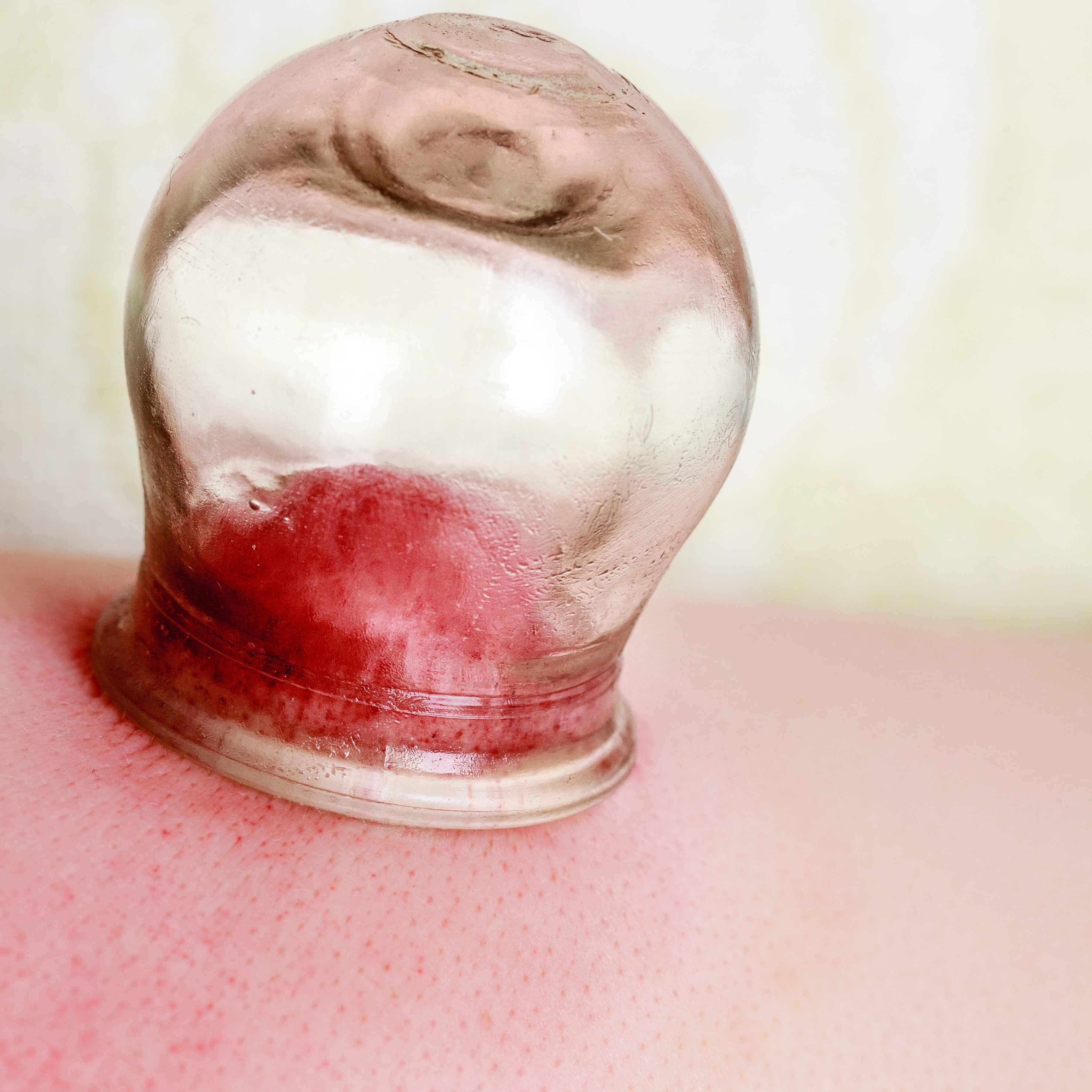 食療如何幫助調(diào)理體內(nèi)濕氣重,數(shù)據(jù)驅(qū)動(dòng)服務(wù)解決案_視野版43.27.31