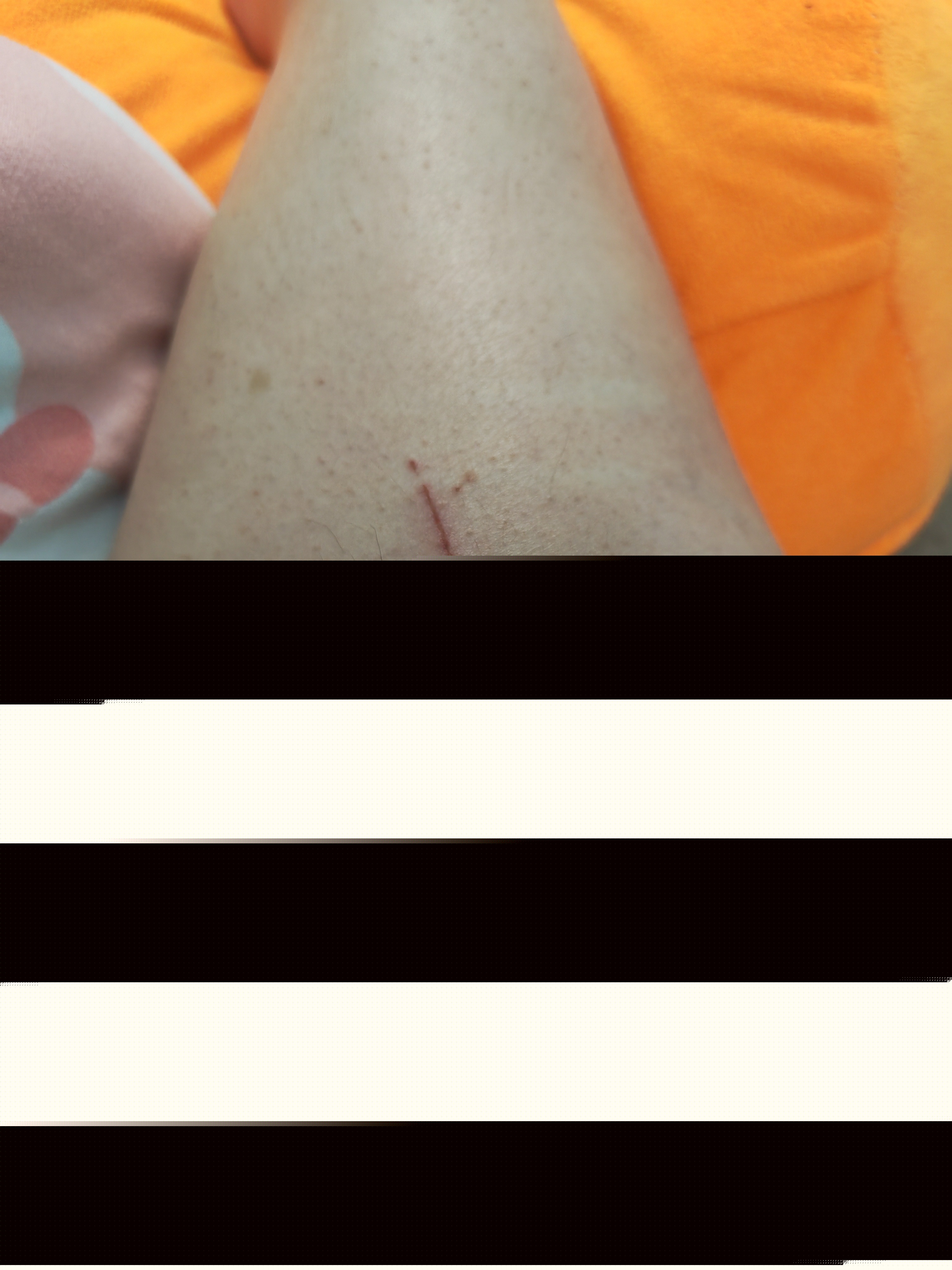 如何處理旅行中的小傷口和劃痕,AI設(shè)備提升計(jì)劃_智航版39.68.33